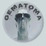 Гematoma